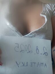 Susan, Galanta, 31 rokov