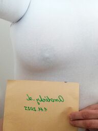 Mia, Bratislava - Devínska Nová Ves, 32 rokov